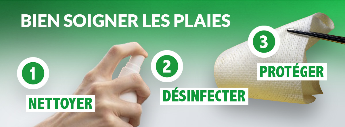Bien soigner les plaies – Les bons gestes à adopter